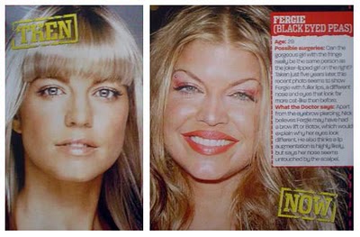 Fergie plastic surgery before after picture